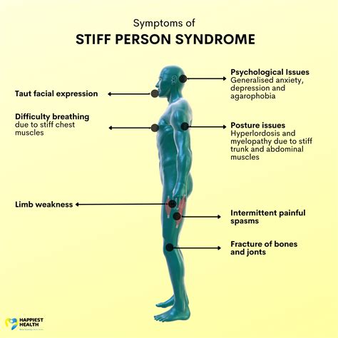 stiff-personsyndroom